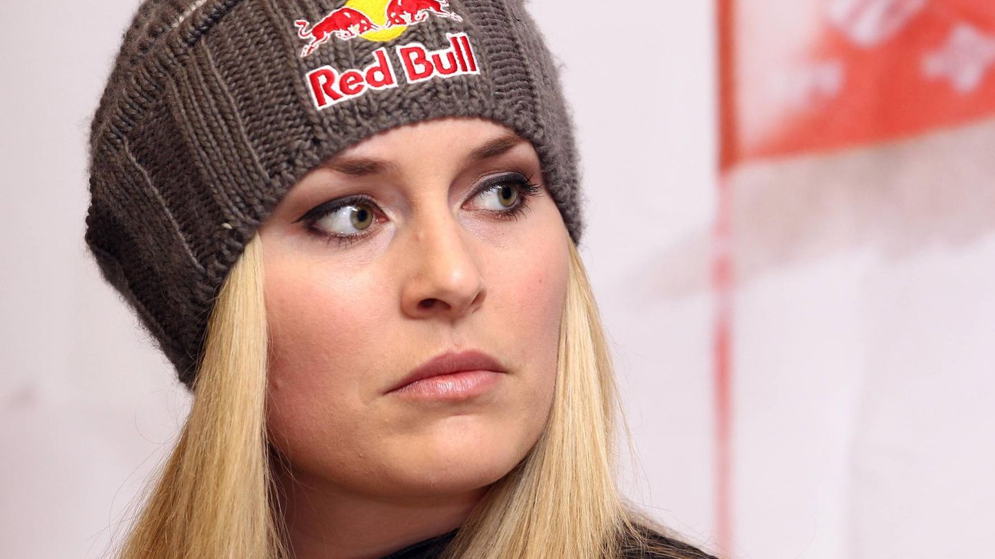 Schock-Fotos: Ski-Star Lindsey Vonn Zeigt Ihre Krassesten Verletzungen