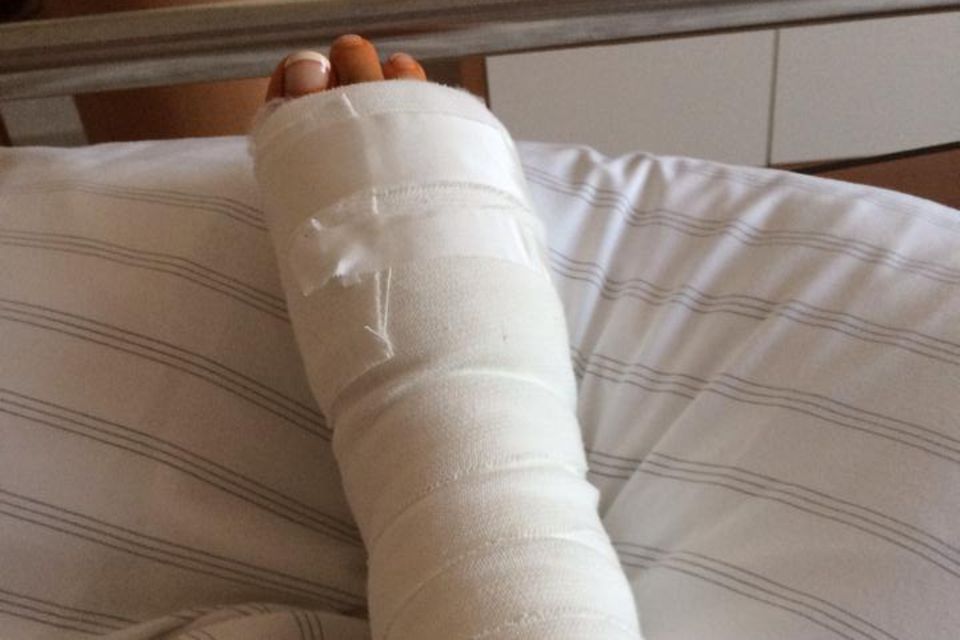 Verena Kerth zeigt ihren Fuß
