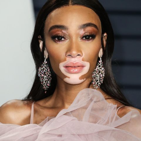 Model Winnie Harlow wearing a Monsoori gown arrives at the 2019 Vanity Fair Oscar Party held at the Wallis Annenberg Center for…