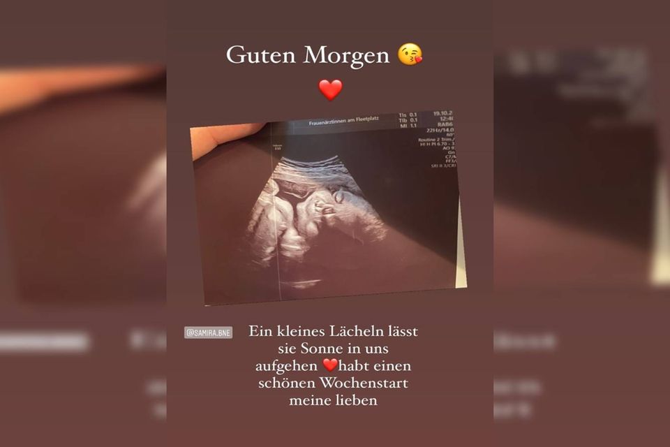 Yasin und Samira zeigen auf Instagram ein Ultraschallfoto ihres Babys