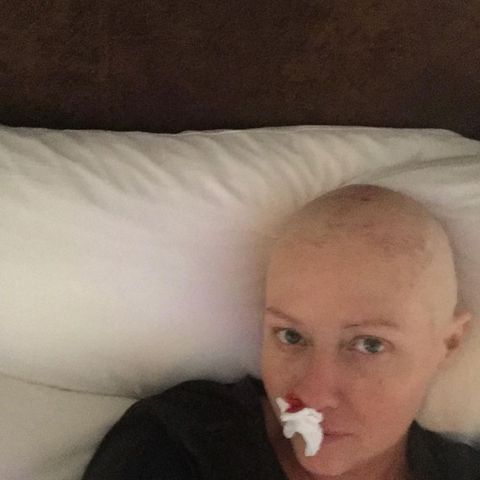 Shannen Doherty teilt Erinnerungen an ihre Brustkrebstherapie mit ihren Followern.