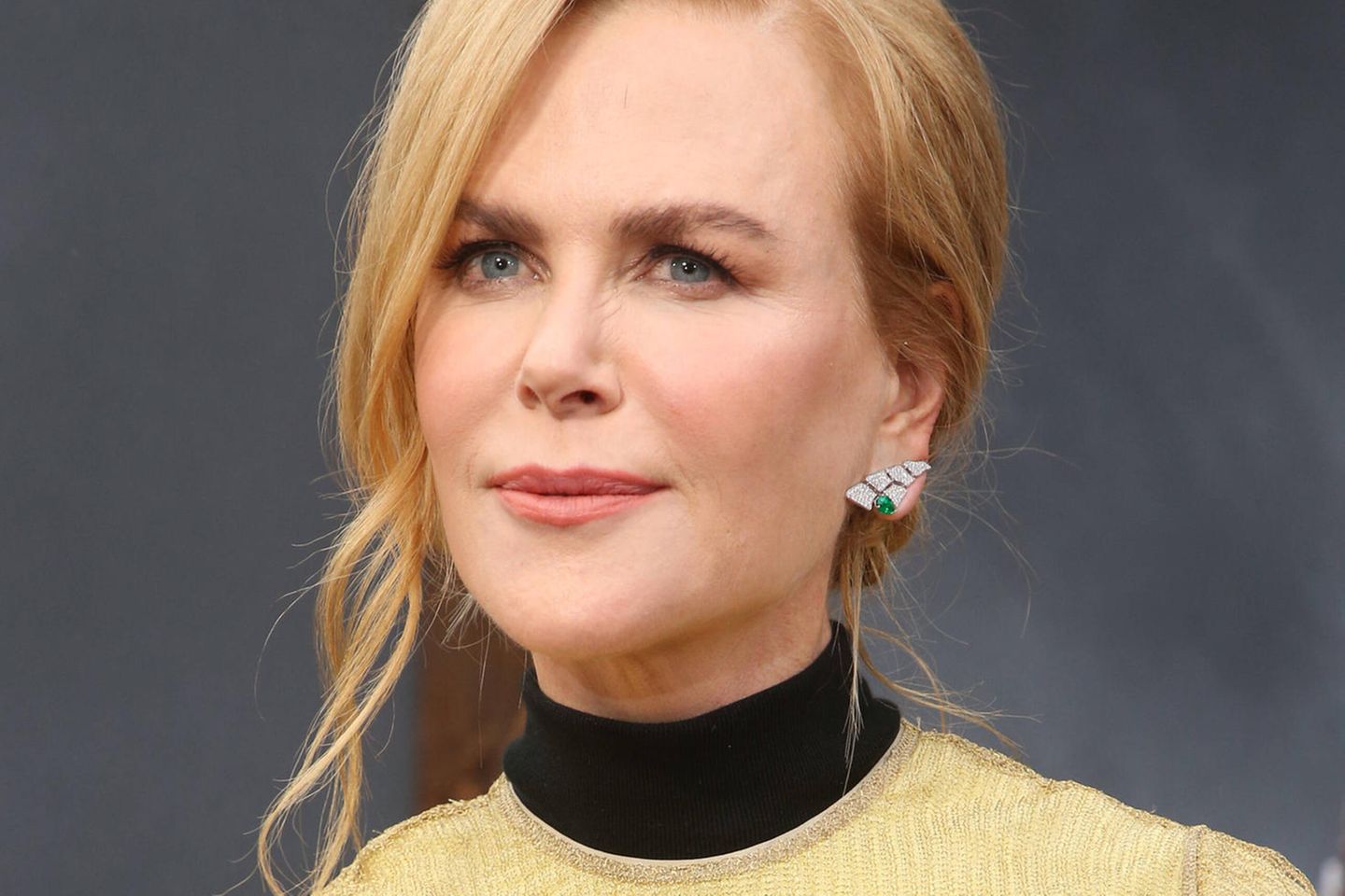 Follower unterstellen Nicole Kidman, dass sie Botox benutzt hat.