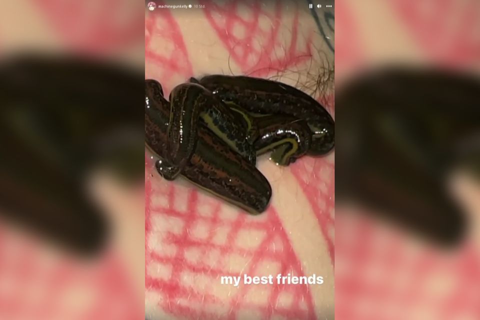 Machine Gun Kelly zeigte in seiner Instagram-Story die Blutegegel auf seinem Bauch.