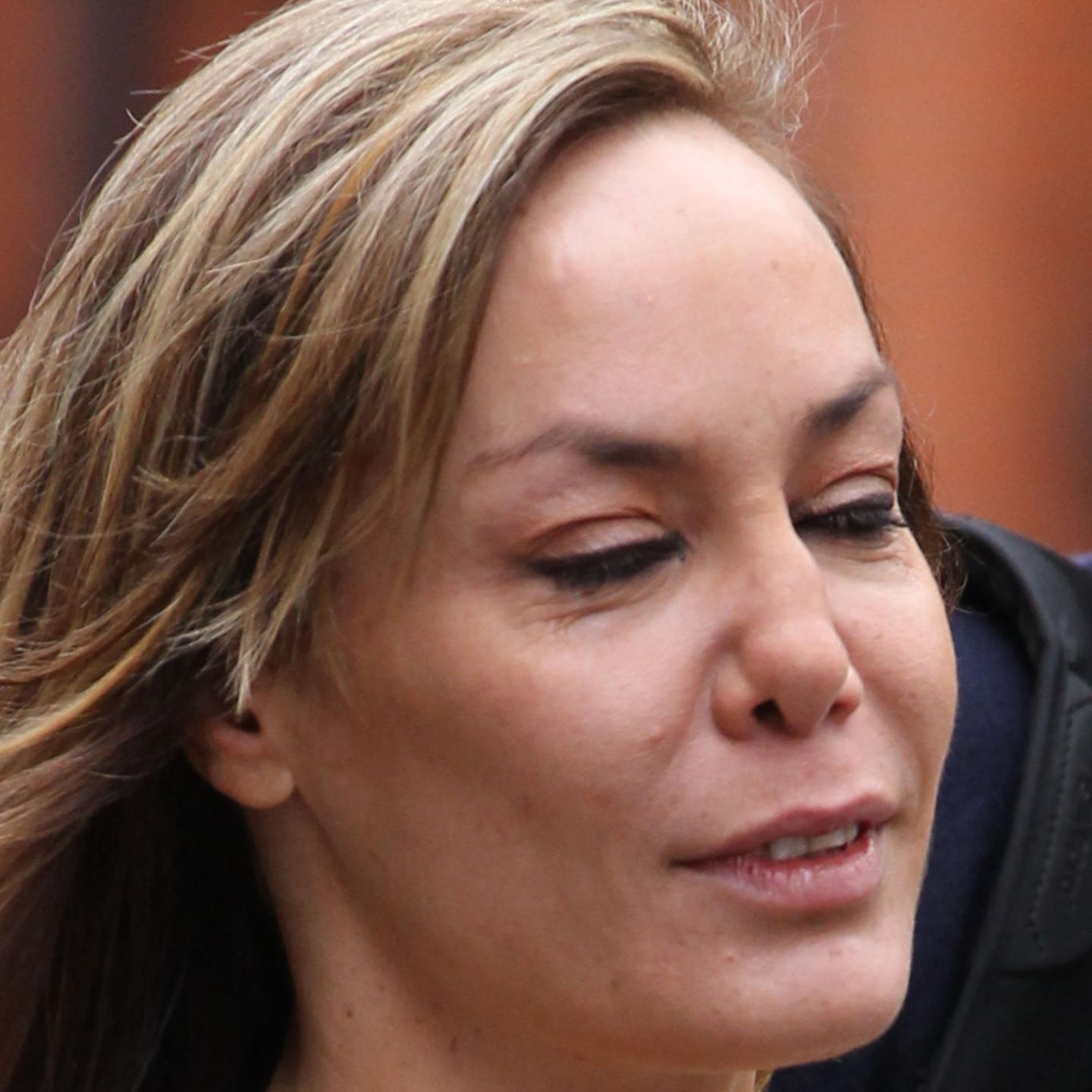 Tara Palmer-Tomkinson: Noch schnell ne neue Nase