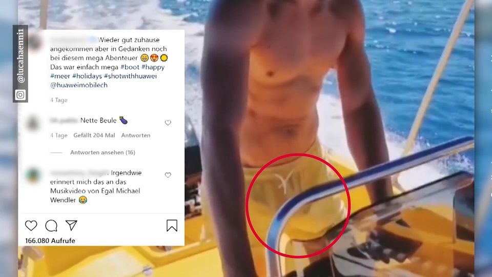 Beule bei Luca Hänni? Wir können mehr