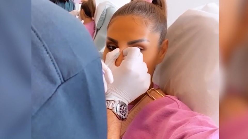 Hier hat der Beauty-Doc nachgeholfen