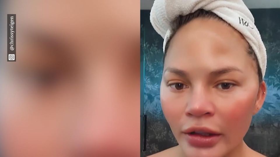 Empörtes Instagram-Comeback