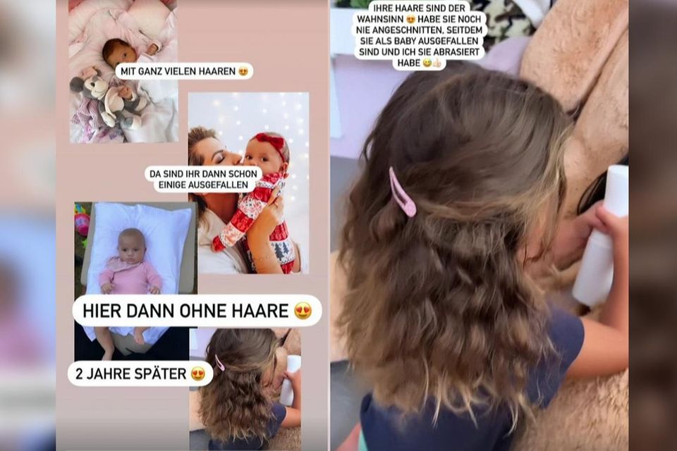 Sarah Harrison zeigt, wie Tochter Kayla als Baby mit absraierten Haaren aussah - und wie sie heute aussieht.