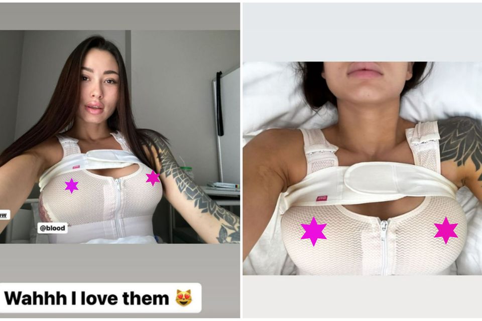 Julian Zietlows Freundin hat sich die Brüste machen lassen