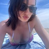 Hot! Markus Söders Tochter Gloria-Sophie Burkandt entspannt am weltbekannten Strand von Santa Monica im gemusterten Bikini. Deutlich zu sehen: Am Tag zuvor scheint sie ein anderes Top getragen zu haben, der Sonnenbrand am Dekolleté ist nicht zu übersehen. 