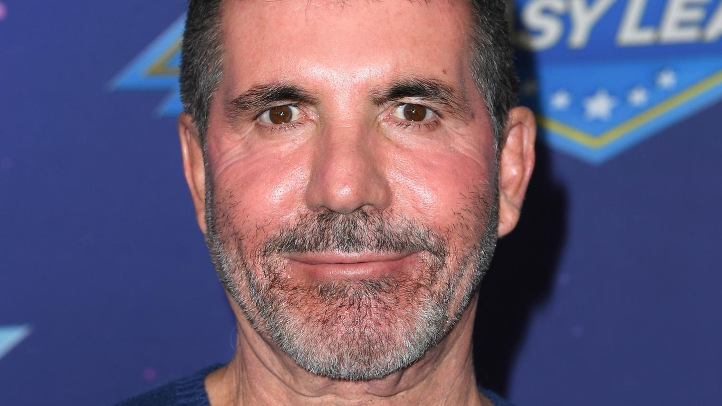 Simon Cowell Krasse BotoxBehandlung schockiert Fans
